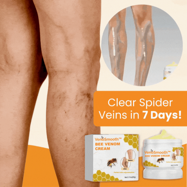 VenoSmooth™