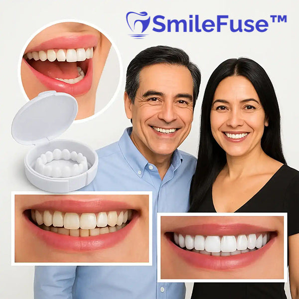 SmileFuse™