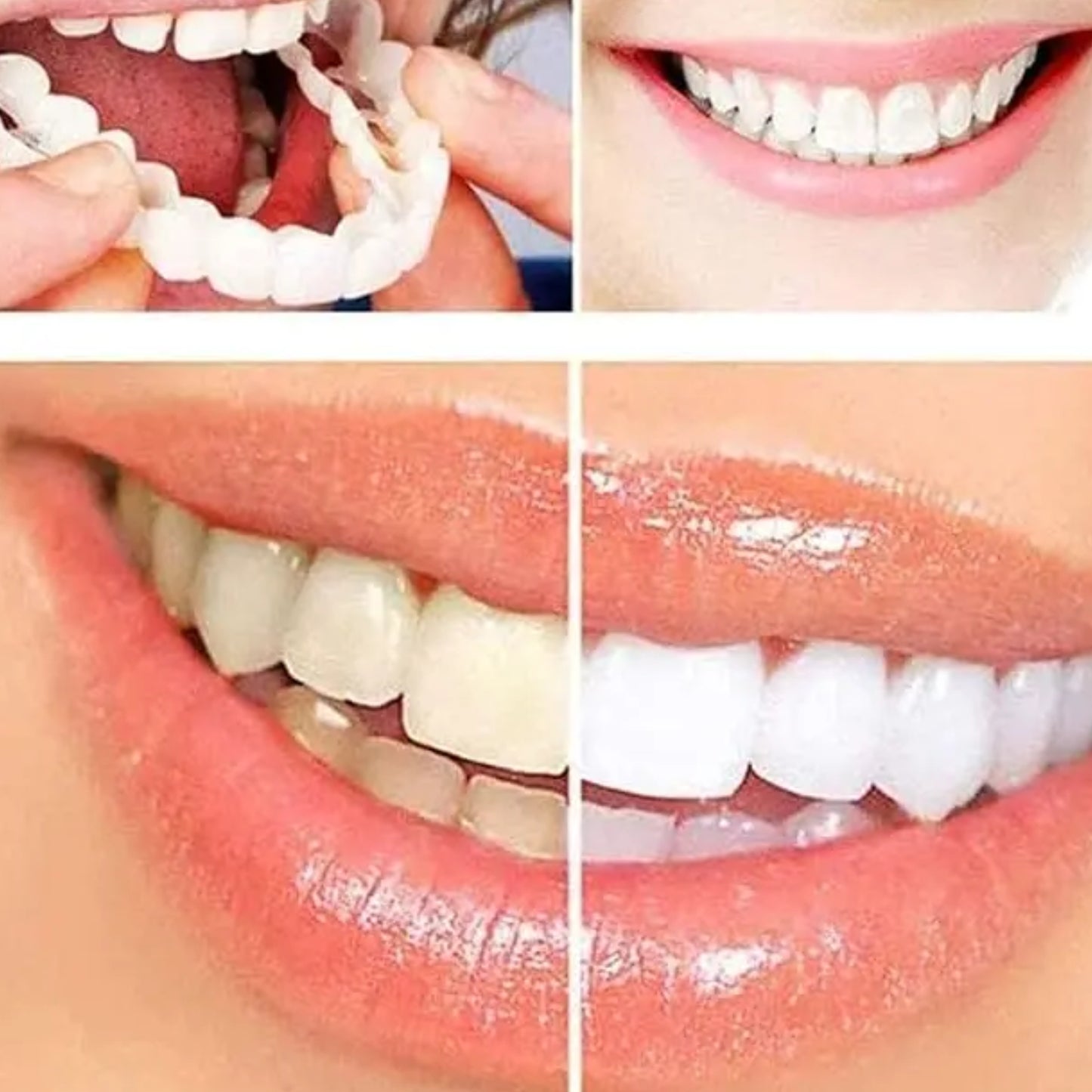 SmileFuse™