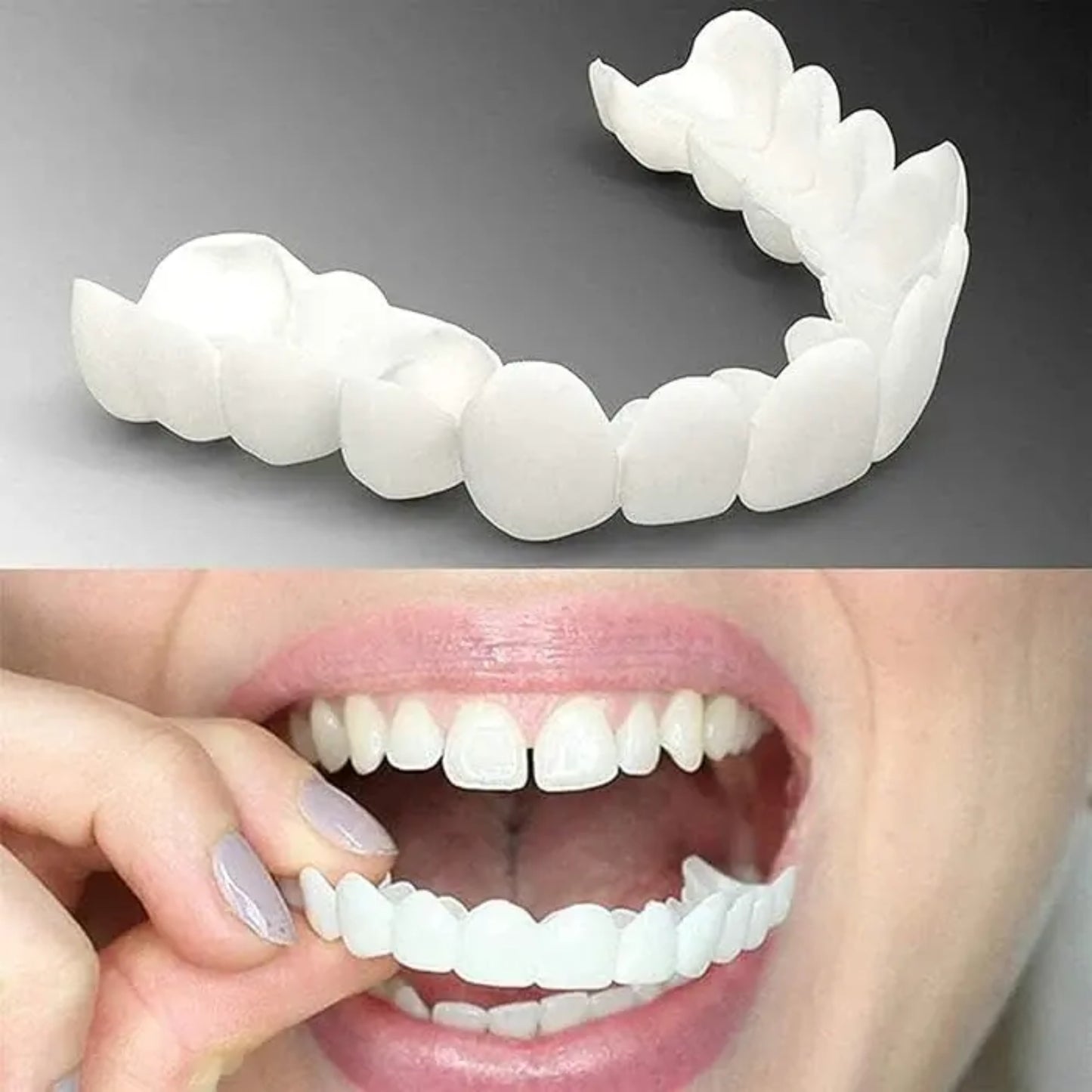 SmileFuse™