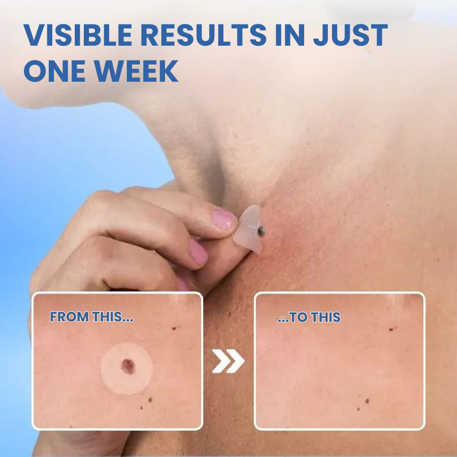 Dermaflux™