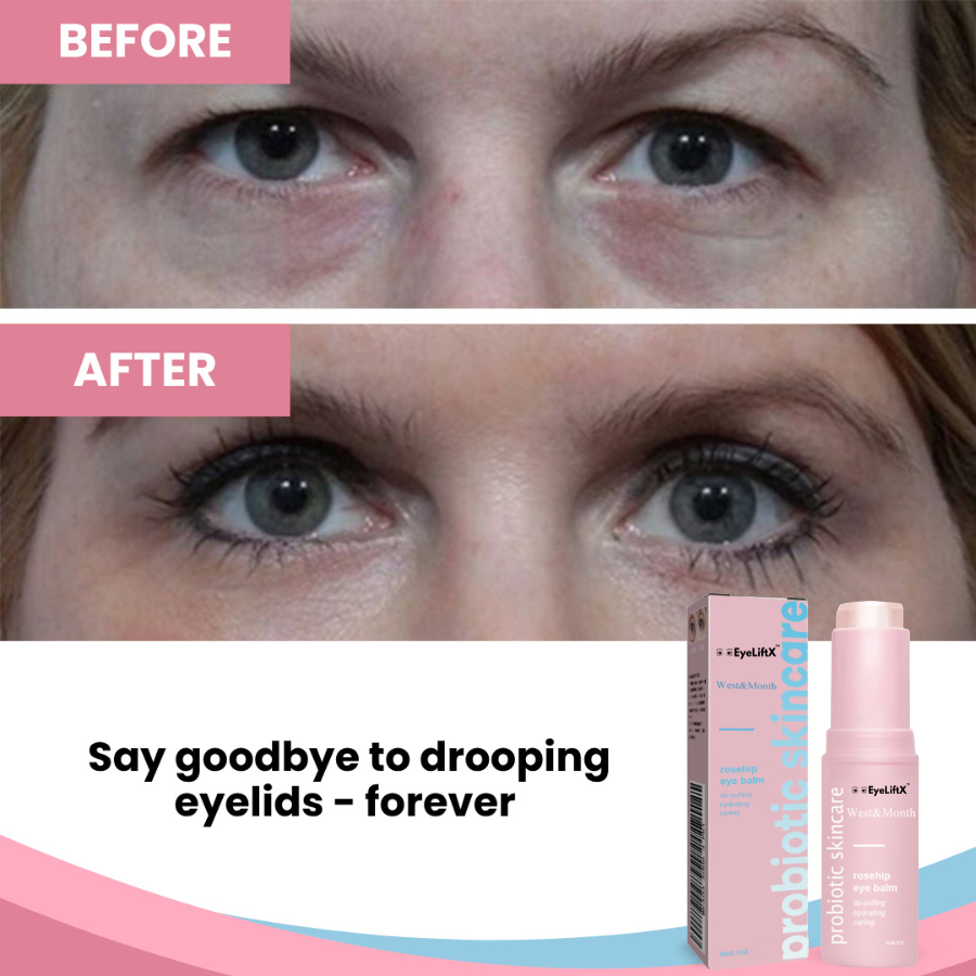 EyeLiftX™