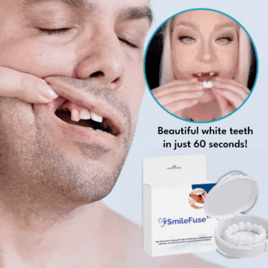 SmileFuse™