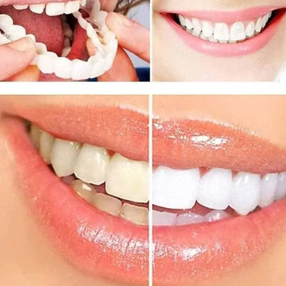 SmileFuse™