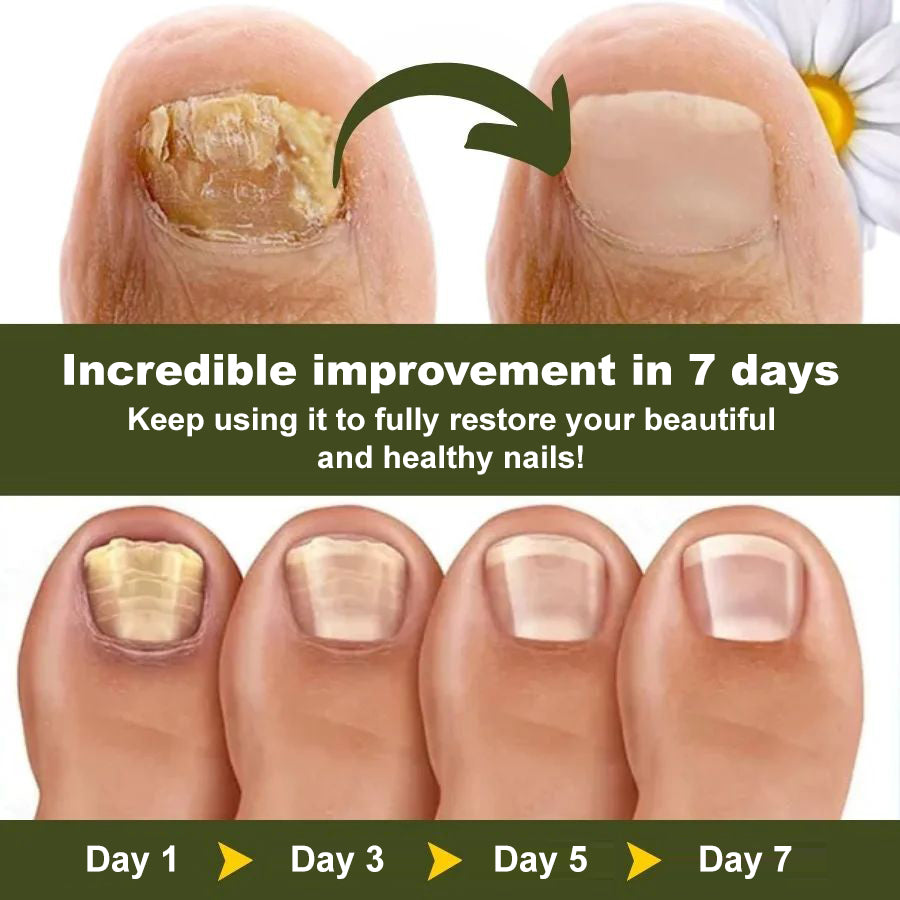 ClearNail™