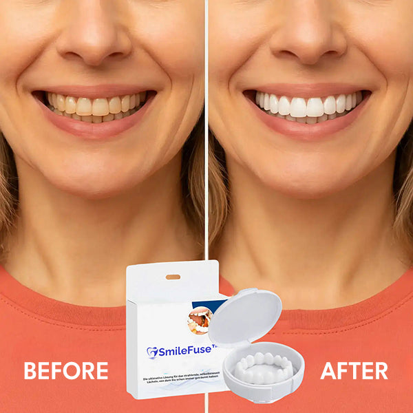 SmileFuse™