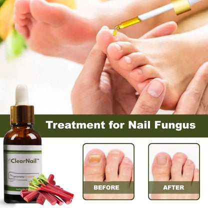 ClearNail™