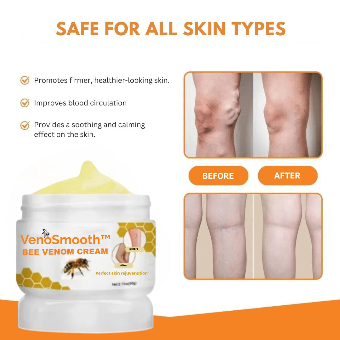 VenoSmooth™