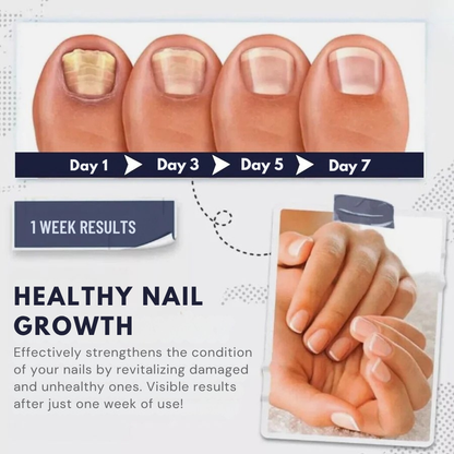 Nailvana™