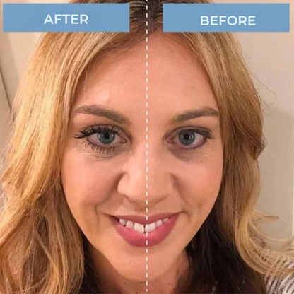 LashRise™